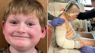 Boy attacked by 'loose' dogs while riding bike, suffers serious injuries