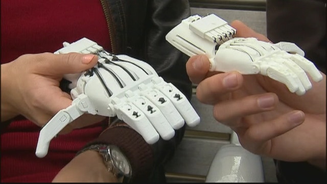 3D prosthetics for kids in need  