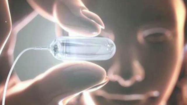 Vitamin-sized pill the latest in weight-loss tech