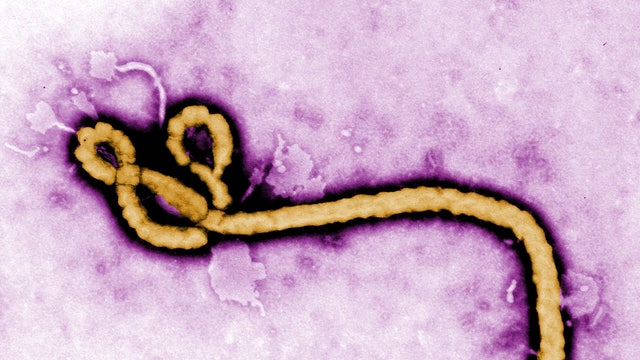 Dr. Manny: No need to panic about Ebola in U.S.