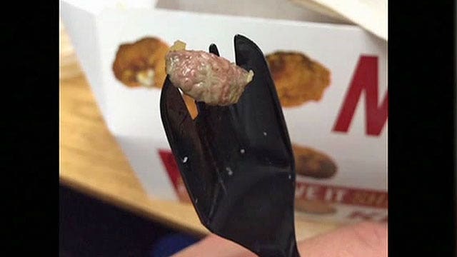 Teen finds chicken organ in KFC lunch