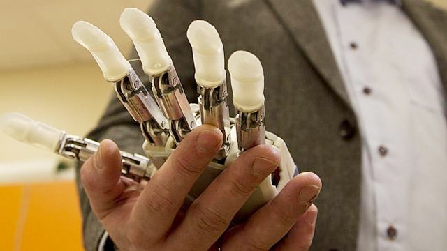 Amputees create bionic hands controlled by brain signals