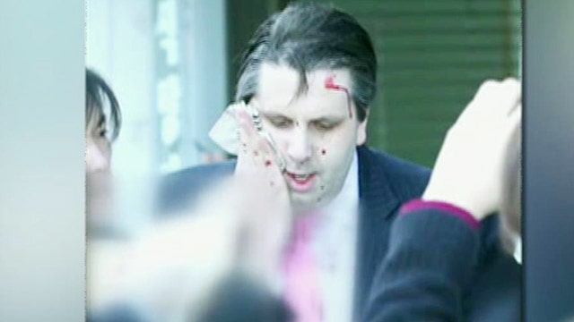 US ambassador to South Korea sliced by man with razor