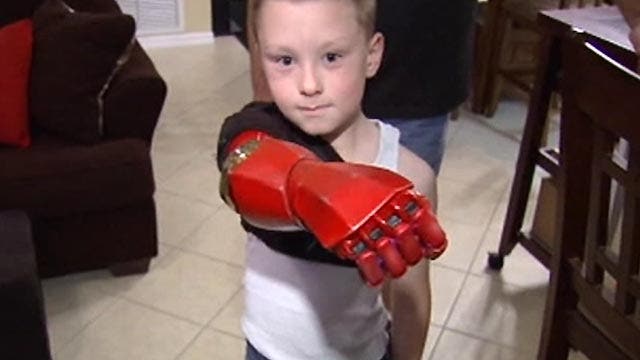 'Iron Man' gives boy 'bionic' arm, confidence boost