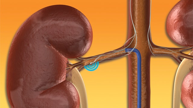 New push to reduce kidney-related deaths worldwide