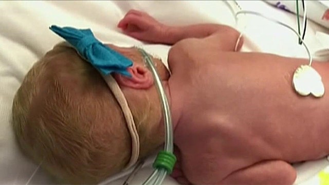 First set of all-girl quintuplets born in the US