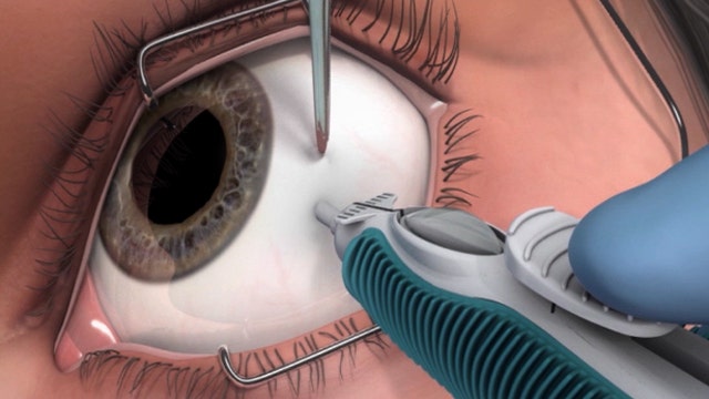 Bionic eye, stomach cancer hope, e-cigarette ban?