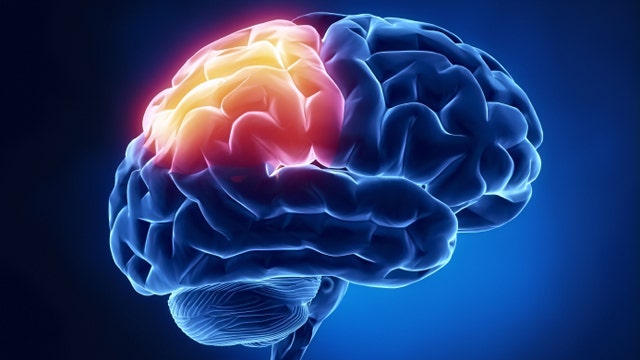 Brain health: Is my memory normal?