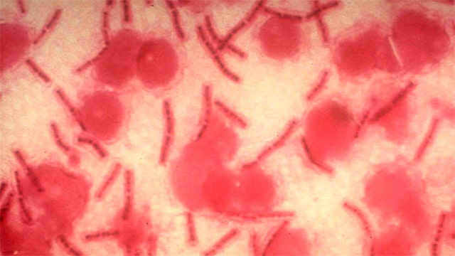 Laboratory mix-up sends live anthrax spores abroad