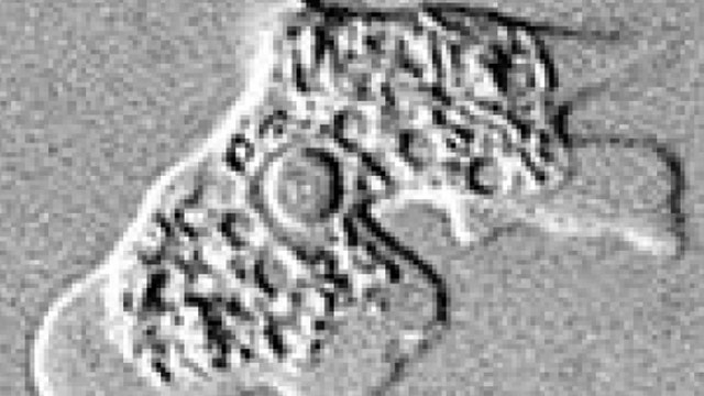 California woman dies after contracting brain-eating amoeba