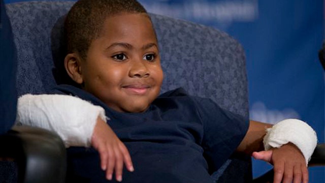 Incredible story of first boy to get double hand transplant