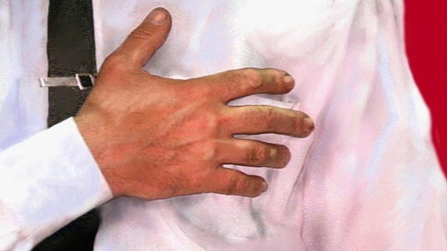 Differences between acid reflux and heartburn