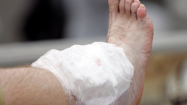 Sprained ankle may have lifelong consequences?