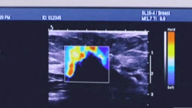 State-of-the-art ultrasound can pinpoint certain cancers