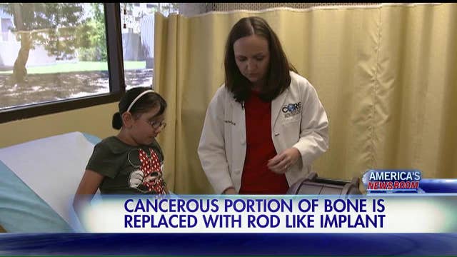 Extendable prosthesis helps kids with bone cancer