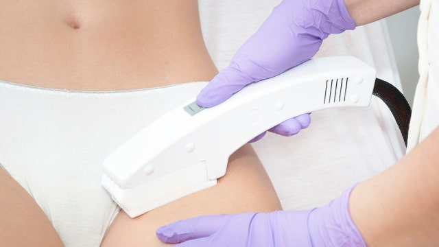Can laser hair removal cause cancer?
