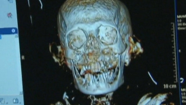 2,300-year-old Egyptian mummy undergoes CT scan