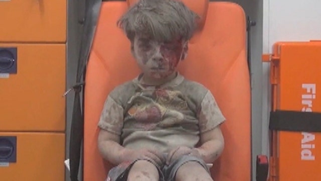 Child's face shows horror of ceaseless war in Syria