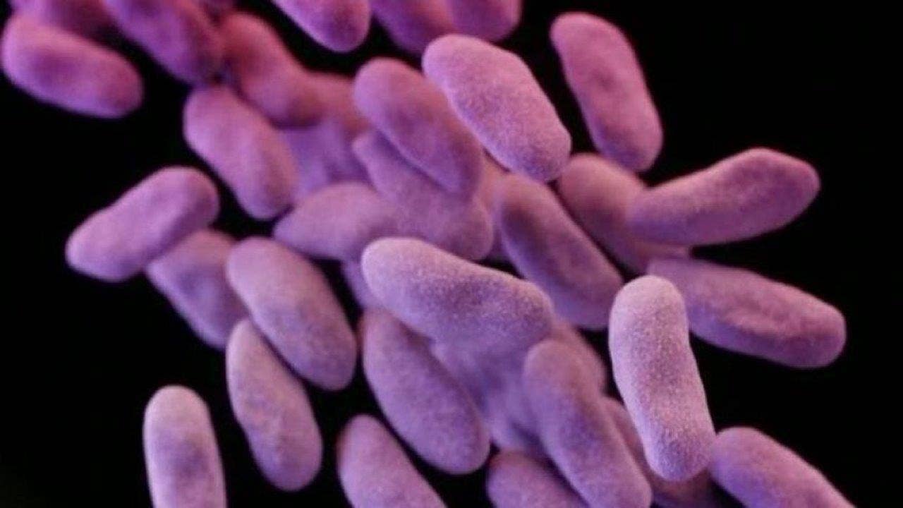 Deadly superbug arrives in US, report says
