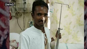 A look at how doctors in India saved a construction worker who was impaled by a 4ft pole on a building site.