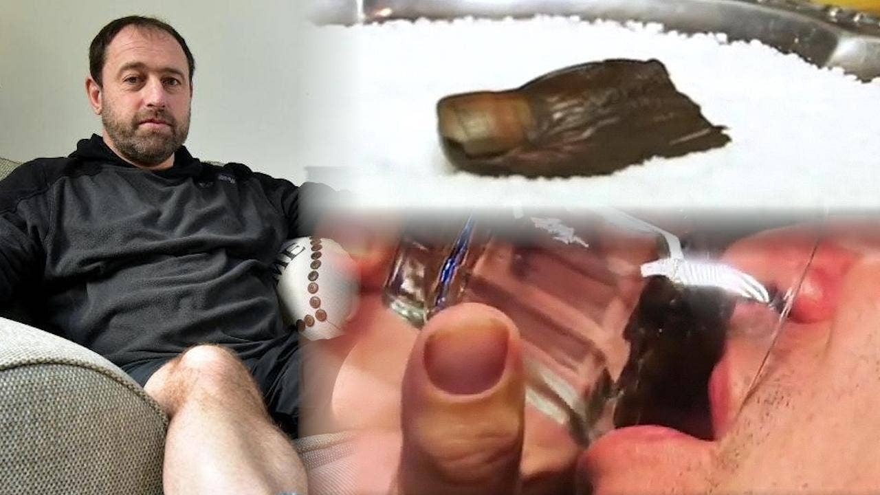 Explorer's frostbitten toes to become cocktail garnish at Canadian bar