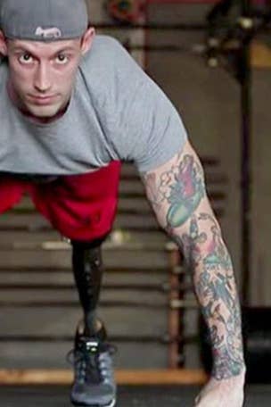 Vet booted for not having 'real legs’?