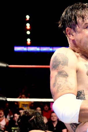 David Arquette's bloody fight