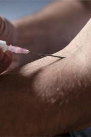 Man tried semen injections for back pain