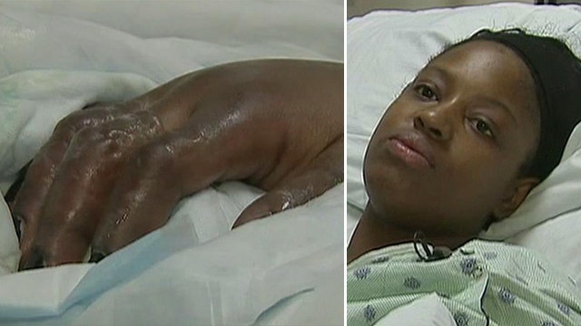 Woman gets frostbite after being outside for just 15 minutes