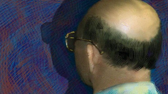 Nutrition the key to preventing, reversing baldness?