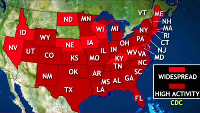 Flu outbreak labeled classic epidemic; 41 states affected