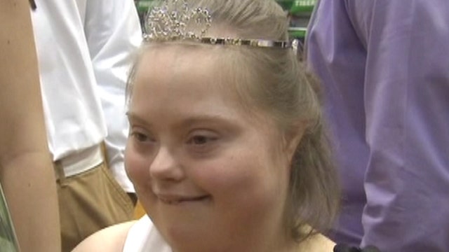 Student with down syndrome elected homecoming queen