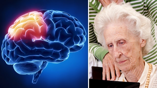 Report: Elderly brains appear slow because they know so much