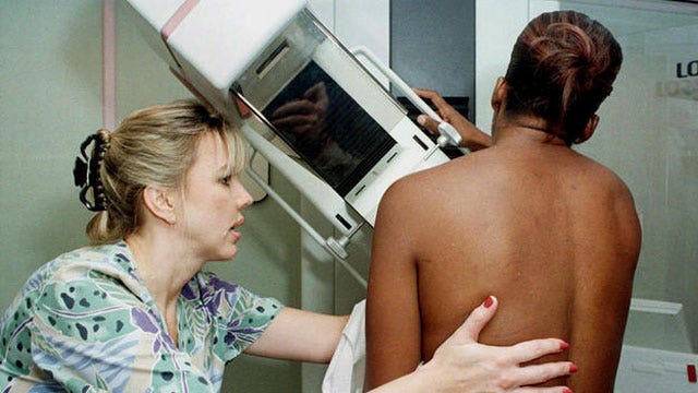 Cancer study researchers suggest fewer mammograms