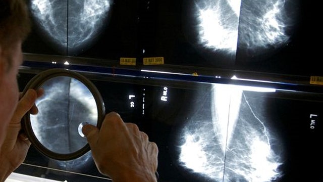 New breast cancer guidelines