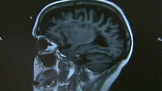 Thickness of brain matter linked to intelligence?