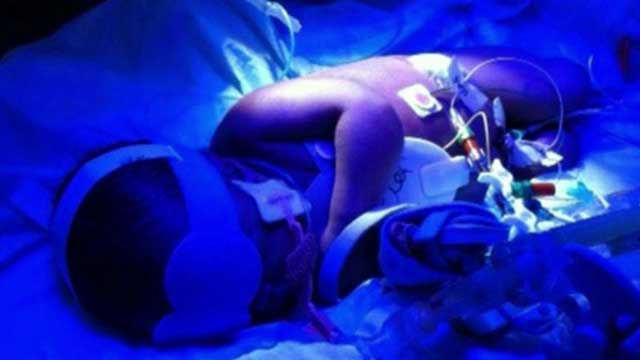 Baby boy 'frozen' for four days to save his life