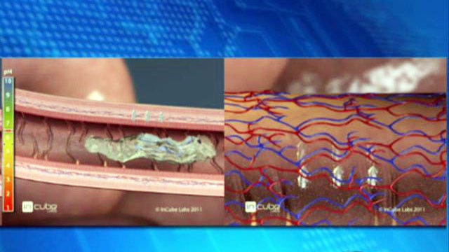 Could 'robotic' pills replace need for injectable drugs?