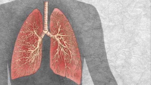 First human lung grown in lab