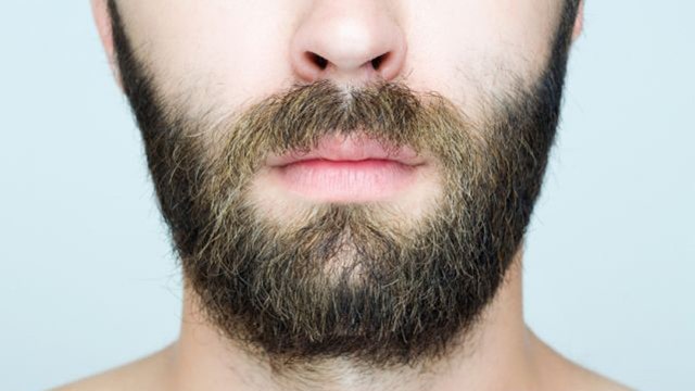 Beard transplants on the rise