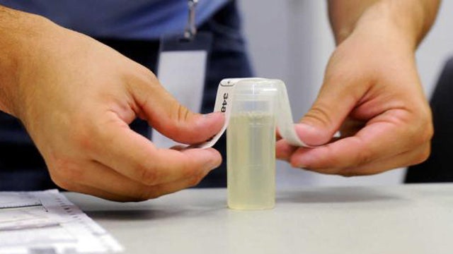 Drug testing for welfare recipients 