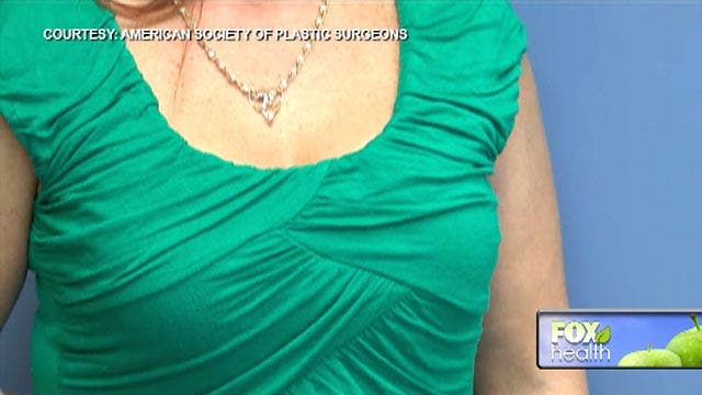 Breast lifts surging in popularity