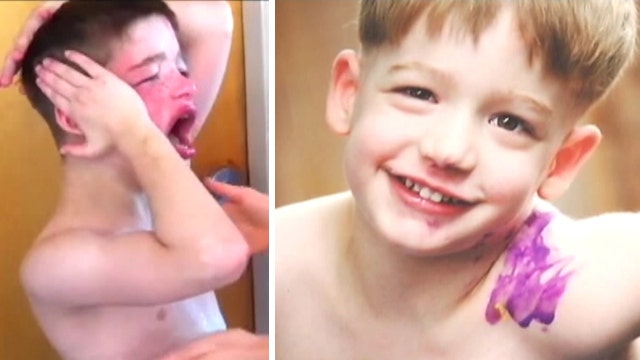 Severely autistic boy uses medical marijuana for treatment