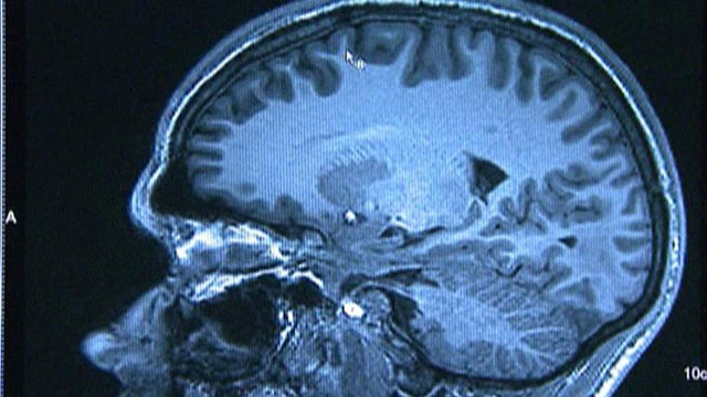 Can brain scans forecast future crimes?