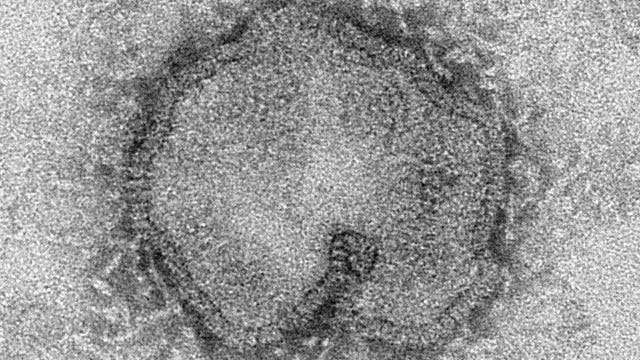New Bird Flu strain shows signs of drug resistance?