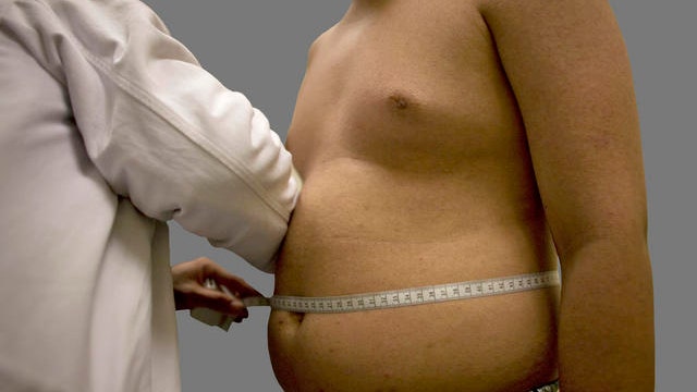 Overweight men at greater risk of prostate cancer