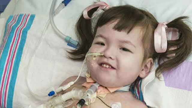 Child gets trachea made from own stem cells