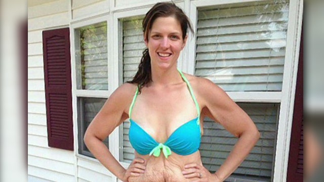 Shape agrees to publish woman's weight loss bikini photo