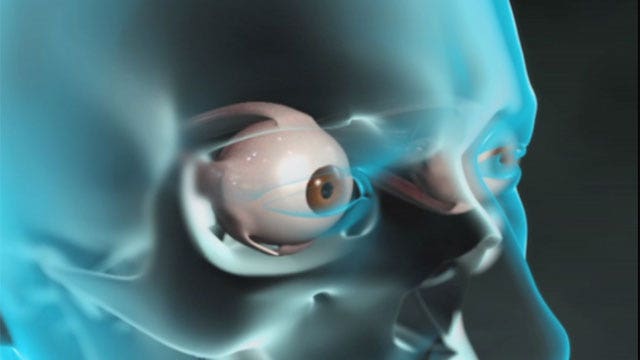 What happens during cataract surgery?