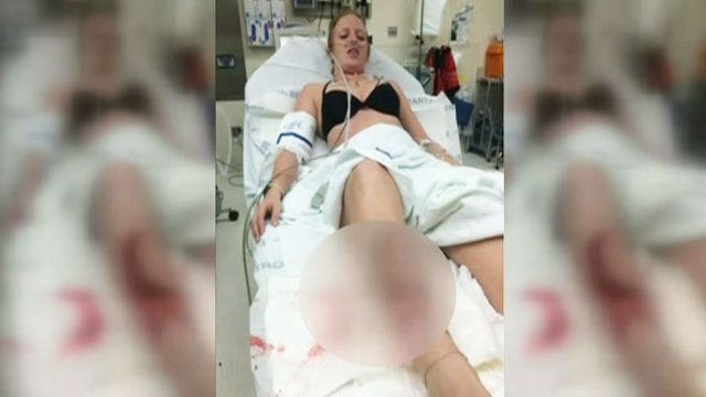 Shark attack victim recovers after harrowing encounter